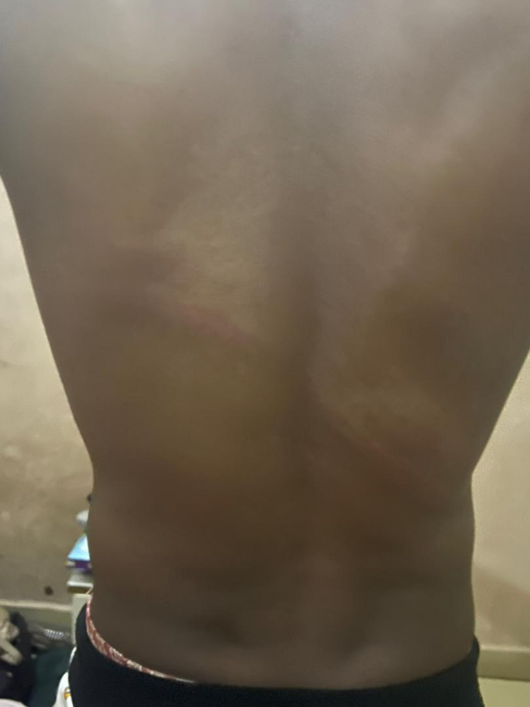Katsina Students Brutalised, Extorted for Not Running When They Saw Policemen 4